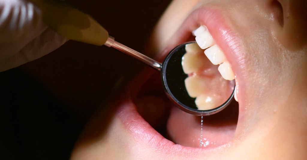 Woman Couldn’t Chew for 2 Years After ‘Horror’ Dental Surgery, She Says