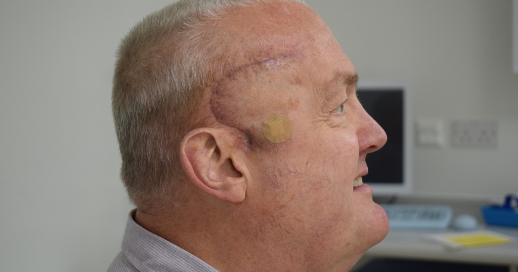 Man’s Brain Tumor Shrinks by Half Amid Clinical Trial